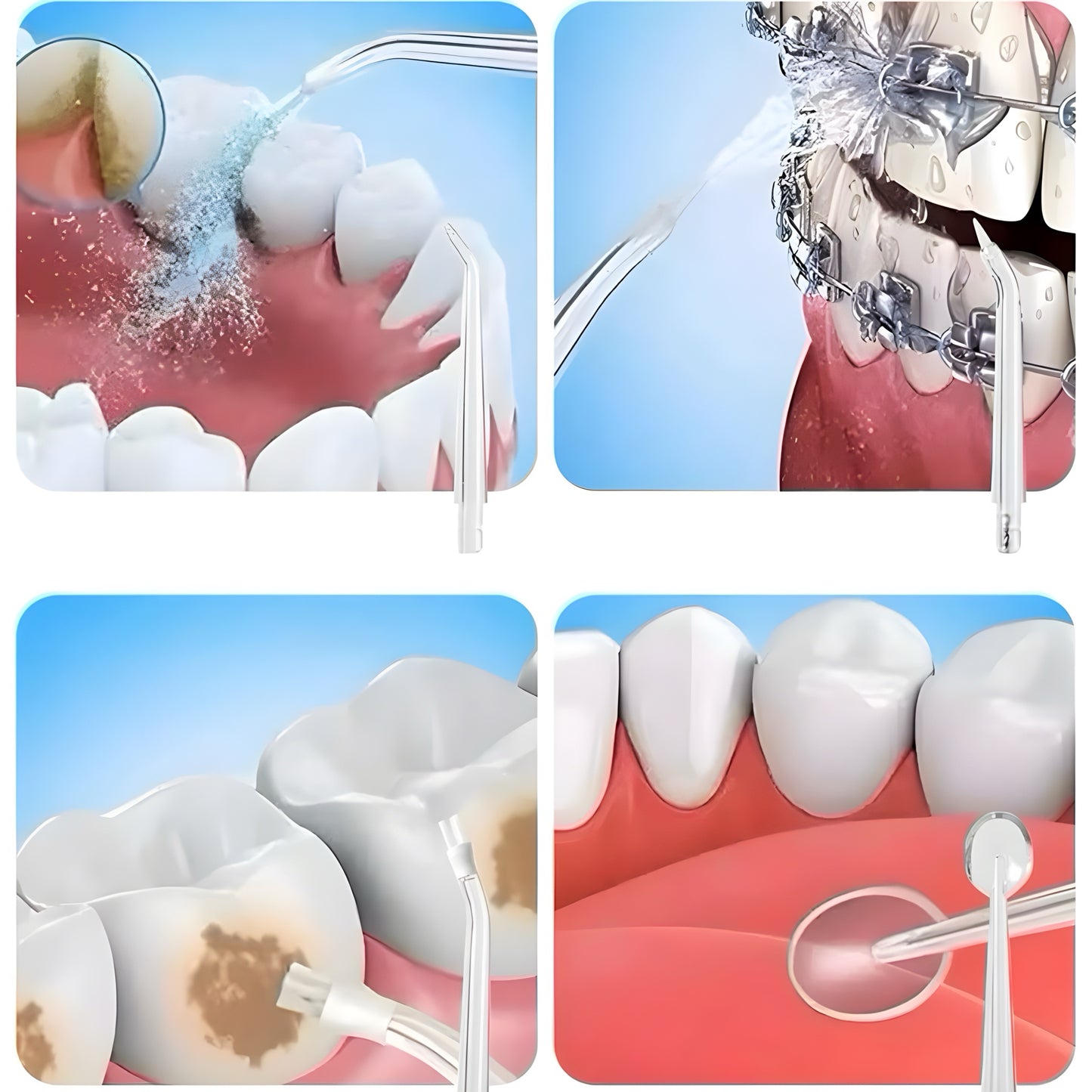 HidroFloss™ 😬 Irrigador Bucal 4 en 1, portátil y recargable USB.