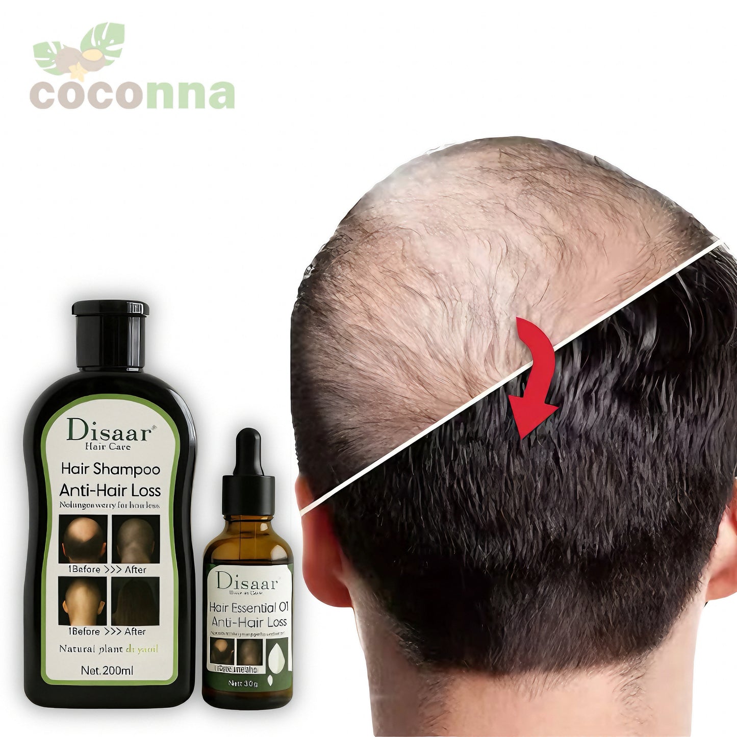 HairBloom™ 🌿 Pack Shampoo + Serum Anticaida.